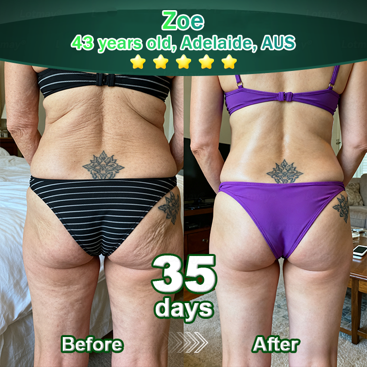 𝐎𝐟𝐟𝐢𝐜𝐢𝐚𝐥𝐥𝐲 𝐀𝐮𝐭𝐡𝐨𝐫𝐢𝐬𝐞𝐝 𝑬𝒙𝒄𝒍𝒖𝒔𝒊𝒗𝒆 𝑬𝒅𝒊𝒕𝒊𝒐𝒏✅𝑇𝑟𝑖𝑙𝑢𝑚𝑖𝑎® 𝖢𝗁𝗅𝗈𝗋𝗈𝗉𝗁𝗒𝗅𝗅 & 𝑆𝑡𝑒𝑚 𝐶𝑒𝑙𝑙 𝖻𝗈𝖽𝗒 𝗋𝖾𝗇𝖾𝗐𝖺𝗅 𝗌𝖾𝗋𝗎𝗆（𝐿𝑖𝑓𝑡 & 𝐹𝑖𝑟𝑚 𝑆𝑎𝑔𝑔𝑖𝑛𝑔 𝑆𝑘𝑖𝑛 & 𝑅𝑒𝑑𝑢𝑐𝑒 𝑊𝑟𝑖𝑛𝑘𝑙𝑒 𝐹𝑜𝑟𝑚𝑎𝑡𝑖𝑜𝑛👍