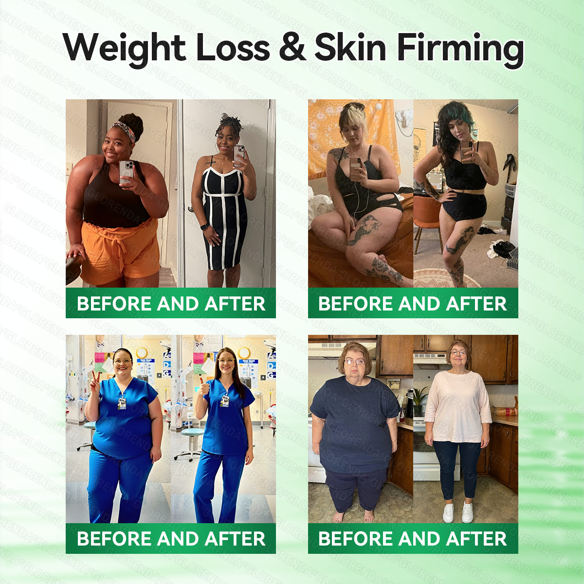 𝐆𝐋𝐎𝑹𝑬𝑵𝑫𝗔®𝑴𝒐𝒓𝒊𝒏𝒈𝗮 · 𝗕𝗲𝗿𝗯𝗲𝗿𝙞𝙣𝙚 × 𝙉𝘼𝐃+ 𝟏𝟎-𝐢𝐧-𝟏 𝗔𝗱𝘃𝗮𝗻𝗰𝙚𝙙 𝙉𝙖𝙣𝙤 𝙈𝙞𝙘𝙧𝙤𝙣𝙚𝙚𝐝𝐥𝐞 𝐏𝐚𝐭𝙘𝙝🇬🇧(𝐉𝐮𝐬𝐭 𝐨𝐧𝐜𝐞 𝐚 𝐝𝐚𝐲, 𝐯𝐢𝐬𝐢𝐛𝐥𝐞 𝐜𝐡𝐚𝐧𝐠𝐞𝐬 𝐢𝐧 𝟕 𝐝𝐚𝐲𝐬） ✅ 𝐅𝐨𝐫 𝐨𝐛𝐞𝐬𝐢𝐭𝐲, 🅛🅞🅞🅢🅔 🅢🅚🅘🅝,𝐝𝐢𝐚𝐛𝐞𝐭𝐞𝐬, 𝐬𝐥𝐞𝐞𝐩 𝐚𝐩𝐧𝐞𝐚, 𝐣𝐨𝐢𝐧𝐭 𝐢𝐬𝐬𝐮𝐞𝐬, 𝐚𝐧𝐝 𝐦𝐨𝐫𝐞🔴