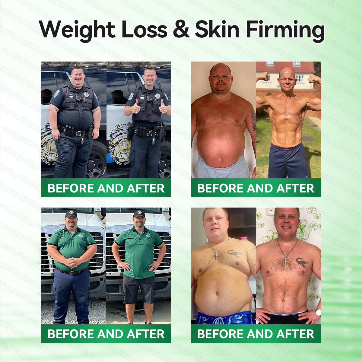 𝐆𝐋𝐎𝑹𝑬𝑵𝑫𝗔®𝑴𝒐𝒓𝒊𝒏𝒈𝗮 · 𝗕𝗲𝗿𝗯𝗲𝗿𝙞𝙣𝙚 × 𝙉𝘼𝐃+ 𝟏𝟎-𝐢𝐧-𝟏 𝗔𝗱𝘃𝗮𝗻𝗰𝙚𝙙 𝙉𝙖𝙣𝙤 𝙈𝙞𝙘𝙧𝙤𝙣𝙚𝙚𝐝𝐥𝐞 𝐏𝐚𝐭𝙘𝙝🇬🇧(𝐉𝐮𝐬𝐭 𝐨𝐧𝐜𝐞 𝐚 𝐝𝐚𝐲, 𝐯𝐢𝐬𝐢𝐛𝐥𝐞 𝐜𝐡𝐚𝐧𝐠𝐞𝐬 𝐢𝐧 𝟕 𝐝𝐚𝐲𝐬） ✅ 𝐅𝐨𝐫 𝐨𝐛𝐞𝐬𝐢𝐭𝐲, 🅛🅞🅞🅢🅔 🅢🅚🅘🅝,𝐝𝐢𝐚𝐛𝐞𝐭𝐞𝐬, 𝐬𝐥𝐞𝐞𝐩 𝐚𝐩𝐧𝐞𝐚, 𝐣𝐨𝐢𝐧𝐭 𝐢𝐬𝐬𝐮𝐞𝐬, 𝐚𝐧𝐝 𝐦𝐨𝐫𝐞🔴