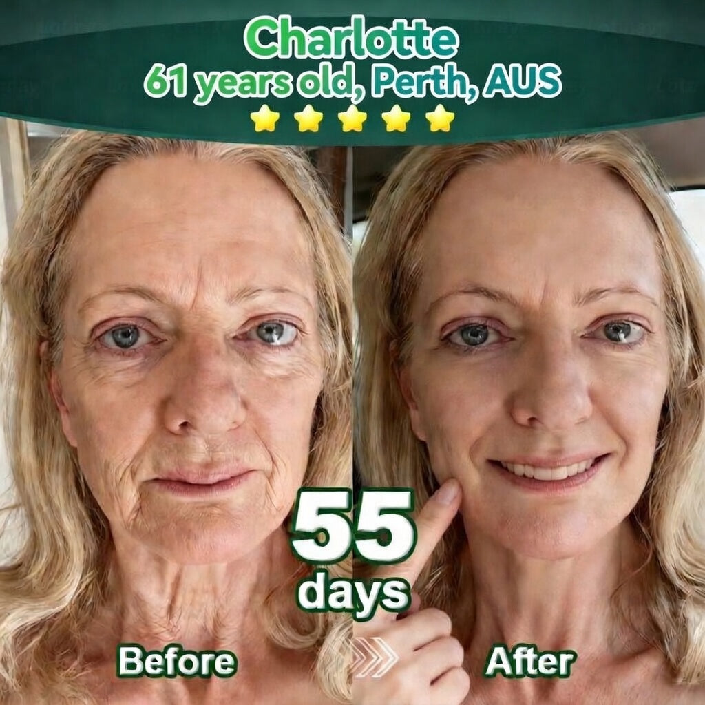 𝐎𝐟𝐟𝐢𝐜𝐢𝐚𝐥𝐥𝐲 𝐀𝐮𝐭𝐡𝐨𝐫𝐢𝐬𝐞𝐝 𝑬𝒙𝒄𝒍𝒖𝒔𝒊𝒗𝒆 𝑬𝒅𝒊𝒕𝒊𝒐𝒏✅𝑇𝑟𝑖𝑙𝑢𝑚𝑖𝑎® 𝖢𝗁𝗅𝗈𝗋𝗈𝗉𝗁𝗒𝗅𝗅 & 𝑆𝑡𝑒𝑚 𝐶𝑒𝑙𝑙 𝖻𝗈𝖽𝗒 𝗋𝖾𝗇𝖾𝗐𝖺𝗅 𝗌𝖾𝗋𝗎𝗆（𝐿𝑖𝑓𝑡 & 𝐹𝑖𝑟𝑚 𝑆𝑎𝑔𝑔𝑖𝑛𝑔 𝑆𝑘𝑖𝑛 & 𝑅𝑒𝑑𝑢𝑐𝑒 𝑊𝑟𝑖𝑛𝑘𝑙𝑒 𝐹𝑜𝑟𝑚𝑎𝑡𝑖𝑜𝑛😈