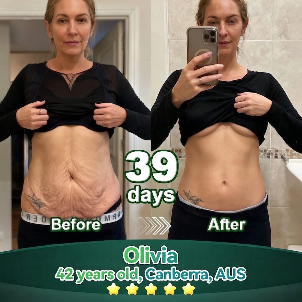 𝐎𝐟𝐟𝐢𝐜𝐢𝐚𝐥𝐥𝐲 𝐀𝐮𝐭𝐡𝐨𝐫𝐢𝐬𝐞𝐝 𝑬𝒙𝒄𝒍𝒖𝒔𝒊𝒗𝒆 𝑬𝒅𝒊𝒕𝒊𝒐𝒏✅𝑇𝑟𝑖𝑙𝑢𝑚𝑖𝑎® 𝖢𝗁𝗅𝗈𝗋𝗈𝗉𝗁𝗒𝗅𝗅 & 𝑆𝑡𝑒𝑚 𝐶𝑒𝑙𝑙 𝖻𝗈𝖽𝗒 𝗋𝖾𝗇𝖾𝗐𝖺𝗅 𝗌𝖾𝗋𝗎𝗆（𝐿𝑖𝑓𝑡 & 𝐹𝑖𝑟𝑚 𝑆𝑎𝑔𝑔𝑖𝑛𝑔 𝑆𝑘𝑖𝑛 & 𝑅𝑒𝑑𝑢𝑐𝑒 𝑊𝑟𝑖𝑛𝑘𝑙𝑒 𝐹𝑜𝑟𝑚𝑎𝑡𝑖𝑜𝑛👍