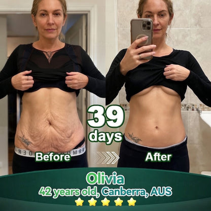 𝐎𝐟𝐟𝐢𝐜𝐢𝐚𝐥𝐥𝐲 𝐀𝐮𝐭𝐡𝐨𝐫𝐢𝐬𝐞𝐝 𝑬𝒙𝒄𝒍𝒖𝒔𝒊𝒗𝒆 𝑬𝒅𝒊𝒕𝒊𝒐𝒏✅𝑇𝑟𝑖𝑙𝑢𝑚𝑖𝑎® 𝖢𝗁𝗅𝗈𝗋𝗈𝗉𝗁𝗒𝗅𝗅 & 𝑆𝑡𝑒𝑚 𝐶𝑒𝑙𝑙 𝖻𝗈𝖽𝗒 𝗋𝖾𝗇𝖾𝗐𝖺𝗅 𝗌𝖾𝗋𝗎𝗆（𝐿𝑖𝑓𝑡 & 𝐹𝑖𝑟𝑚 𝑆𝑎𝑔𝑔𝑖𝑛𝑔 𝑆𝑘𝑖𝑛 & 𝑅𝑒𝑑𝑢𝑐𝑒 𝑊𝑟𝑖𝑛𝑘𝑙𝑒 𝐹𝑜𝑟𝑚𝑎𝑡𝑖𝑜𝑛😈