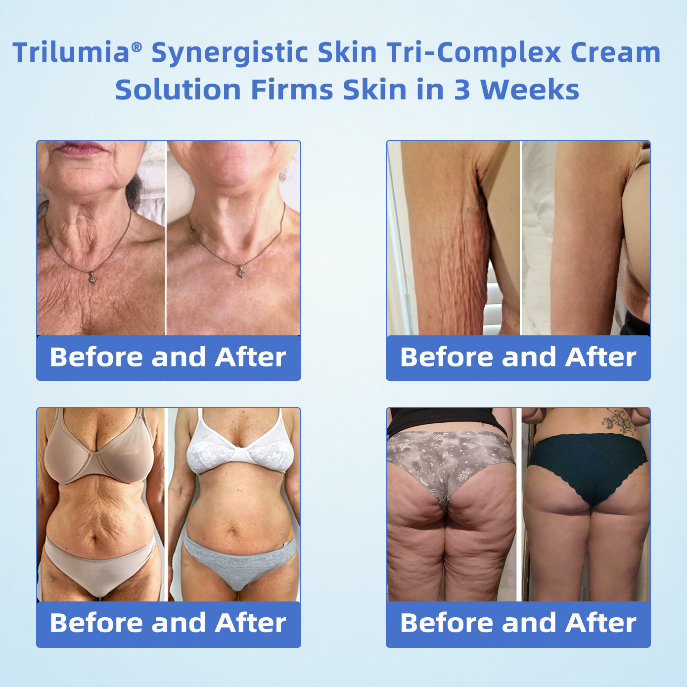 Trilumia® Synergistic Skin Tri-Complex Cream 💎(Copper Peptide+Growth Factors+Methylene Blue)🏆Next-Generation Biotech For Skin Repair